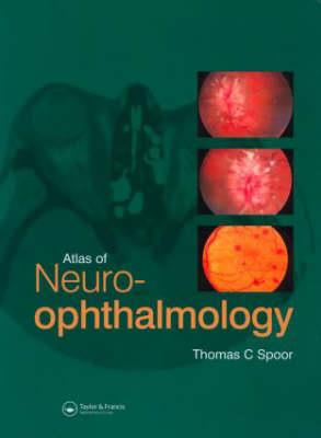 Atlas of Neuro-ophthalmology - Click Image to Close