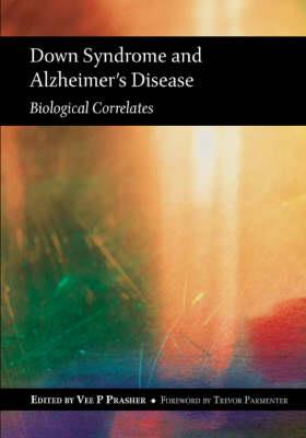 Down Syndrome and Alzheimer's Disease - Click Image to Close