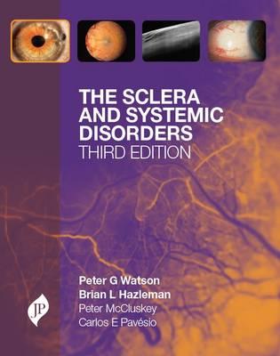 The Sclera and Systemic Disorders - Click Image to Close