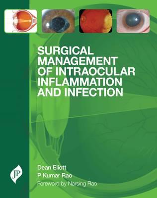 Surgical Management of Intraocular Inflammation and Infection - Click Image to Close