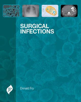 Surgical Infections - Click Image to Close