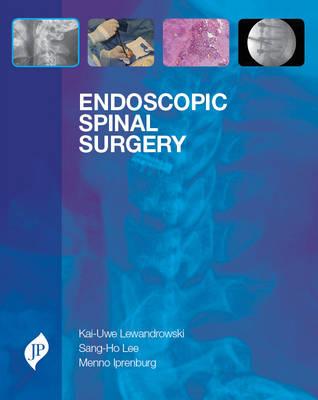 Endoscopic Spinal Surgery - Click Image to Close