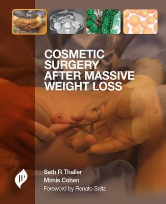 Cosmetic Surgery after Massive Weight Loss - Click Image to Close