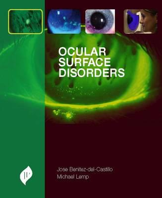 Ocular Surface Disorders - Click Image to Close