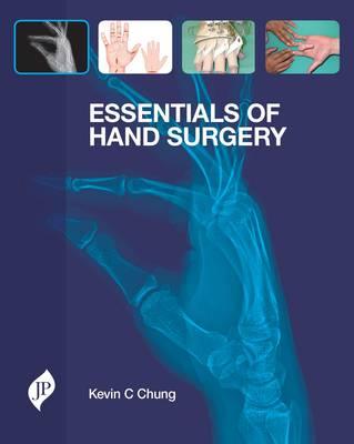 Essentials of Hand Surgery - Click Image to Close