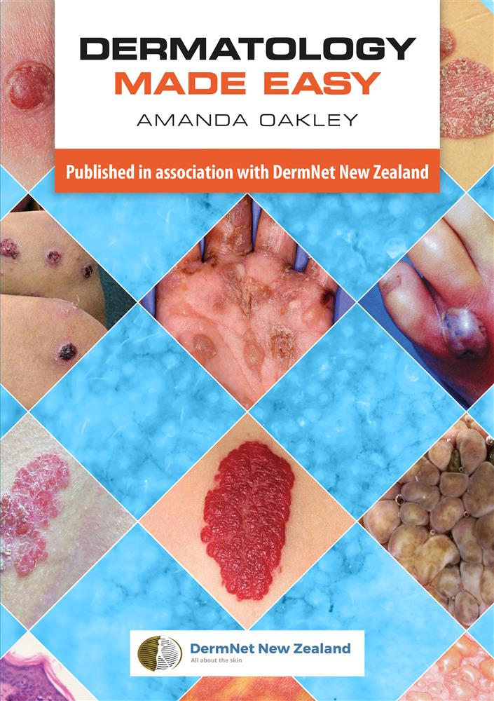 Dermatology Made Easy - Click Image to Close