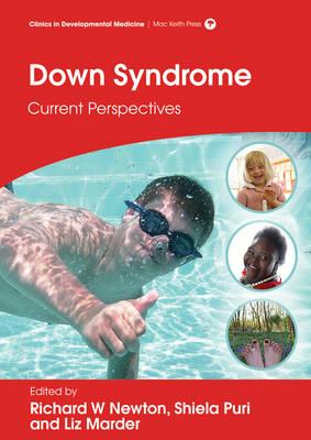 Down Syndrome: Current Perspectives - Click Image to Close