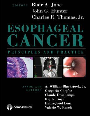 Esophageal Cancer: Principles and Practice - Click Image to Close