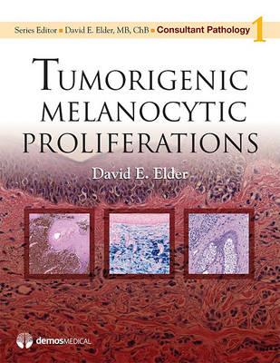 Tumorigenic Melanocytic Proliferations - Click Image to Close