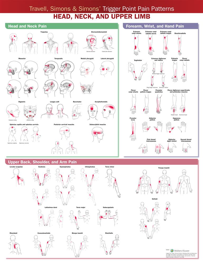 Travell, Simons amp; Simons? Trigger Point Pain Patterns Wall Chart - Click Image to Close