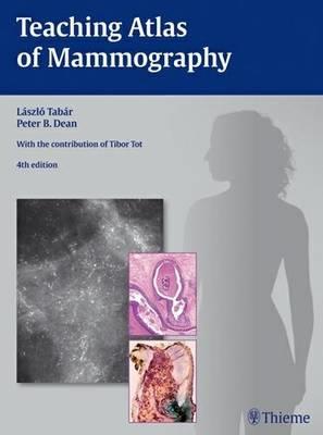 Teaching Atlas of Mammography - Click Image to Close