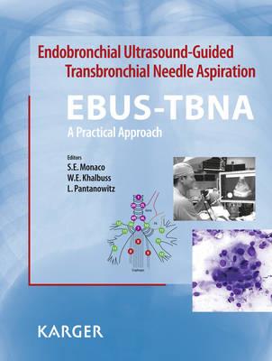 Endobronchial Ultrasound-Guided Transbronchial Needle Aspiration (EBUS-TBNA): A Practical Approach - Click Image to Close