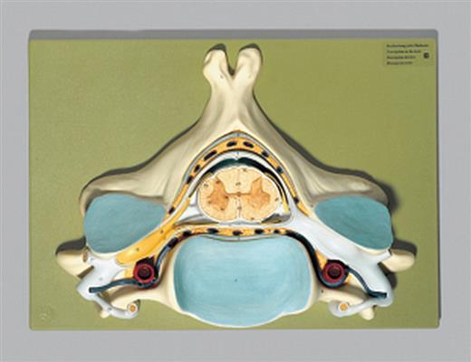 Fifth Cervical Vertebra - Click Image to Close