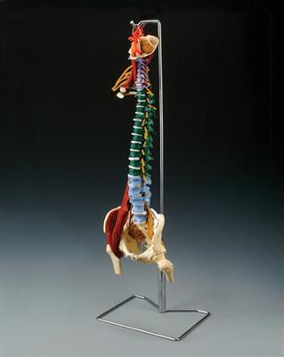 Muscle Spine With Disorders with Stand - Click Image to Close