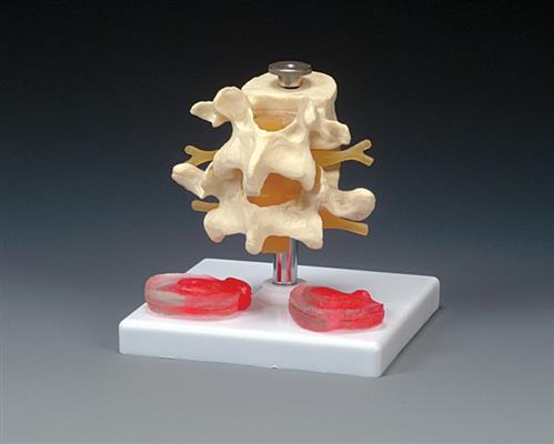 Budget Lumbar Vertebrae With Interchangeable Discs - Click Image to Close