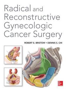 Radical and Reconstructive Gynecologic Cancer Surgery - Click Image to Close