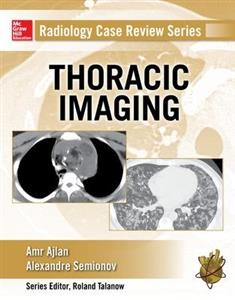 Radiology Case Review Series: Thoracic Imaging - Click Image to Close