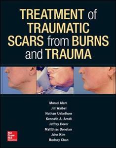 Treatment of Traumatic Scars from Burns and Trauma - Click Image to Close