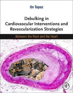 Debulking in Cardiovascular Interventions and Revascularization Strategies: Between a Rock and the Heart - Click Image to Close