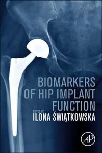 Biomarkers of Hip Implant Function - Click Image to Close