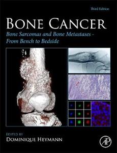 Bone Cancer: Bone Sarcomas and Bone Metastases From Bench to Bedside - Click Image to Close