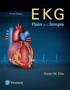 EKG Plain and Simple - Click Image to Close