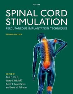 Spinal Cord Stimulation Percutaneous Implantation Techniques - Click Image to Close