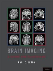 Brain Imaging