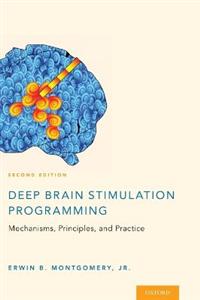 Deep Brain Stimulation Programming - Click Image to Close