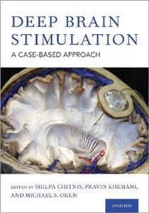 Deep Brain Stimulation A Case-based Approach - Click Image to Close