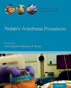 Pediatric Anesthesia Procedures - Click Image to Close