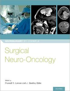 Surgical Neuro-Oncology - Click Image to Close