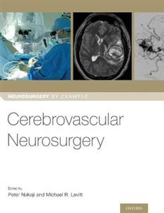 Cerebrovascular Neurosurgery - Click Image to Close