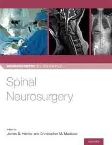 Spinal Neurosurgery - Click Image to Close