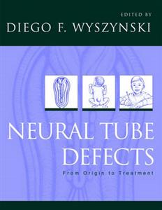 Neural Tube Defects