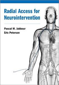 Radial Access for Neurointervention - Click Image to Close