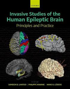 Invasive Studies of the Human Epileptic Brain - Click Image to Close