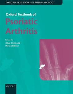 Oxford Textbook of Psoriatic Arthritis - Click Image to Close