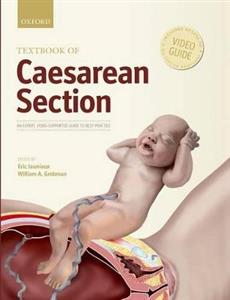 Textbook of Caesarean Section - Click Image to Close