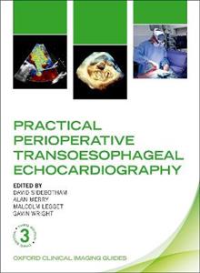 Practical Perioperative Transoesophageal Echocardiography - Click Image to Close