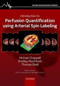 Perfusion Quantification using Arterial Spin Labelling - Click Image to Close