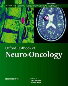 Oxford Textbook of Neuro-Oncology Oxford Textbook of Neuro-Oncology