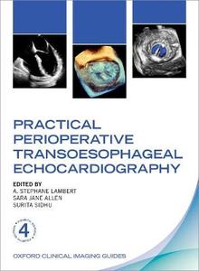Practical Perioperative Transoesophageal Echocardiography Ocig Paperback
