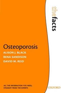 Osteoporosis - Click Image to Close