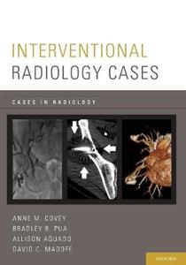 Interventional Radiology Cases - Click Image to Close