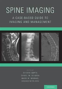 Spine Imaging - Click Image to Close