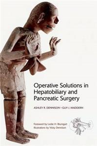 Operative Solutions in Hepatobiliary and Pancreatic Surgery