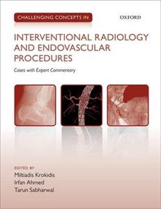 Challenging Concepts in Interventional Radiology - Click Image to Close