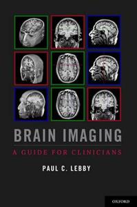 Brain Imaging