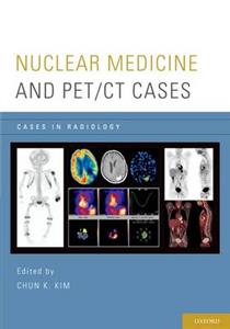 Nuclear Medicine and PET/CT Cases - Click Image to Close